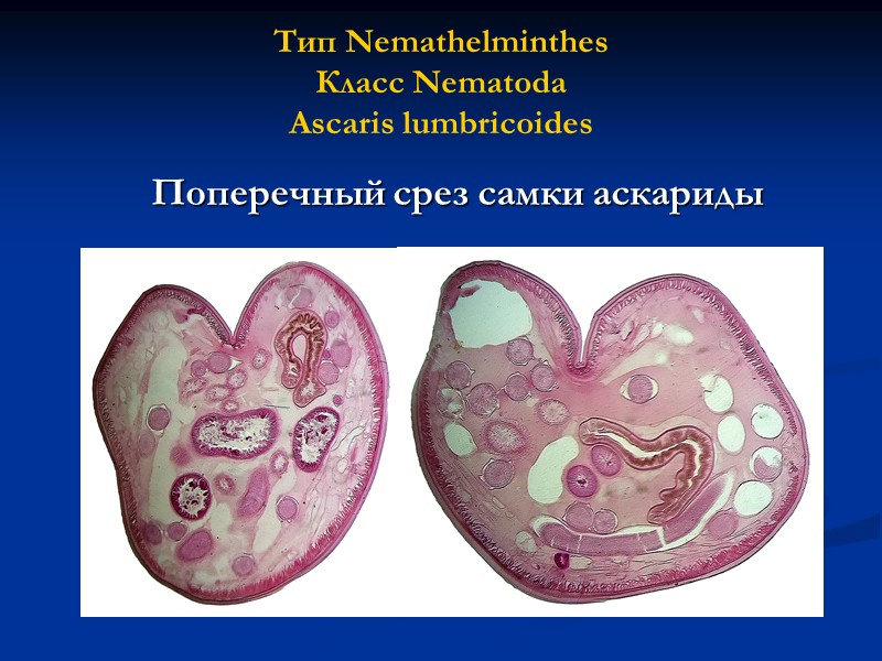 Тип Nemathelminthes Класс Nematoda Ascaris lumbricoides  Поперечный срез самки аскариды